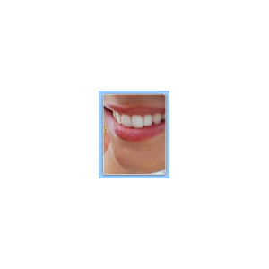 Listing Thumbnail